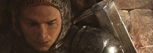 Mordred, Légende et mal de dos